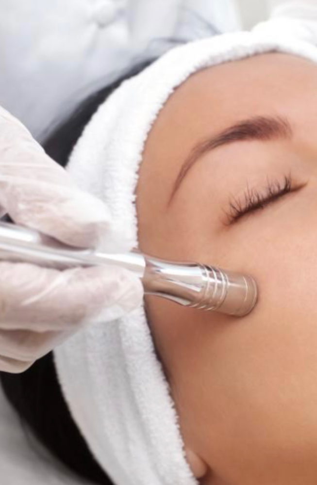 Microdermabrasion Facial