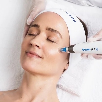 Harmony Advaced Microneedling