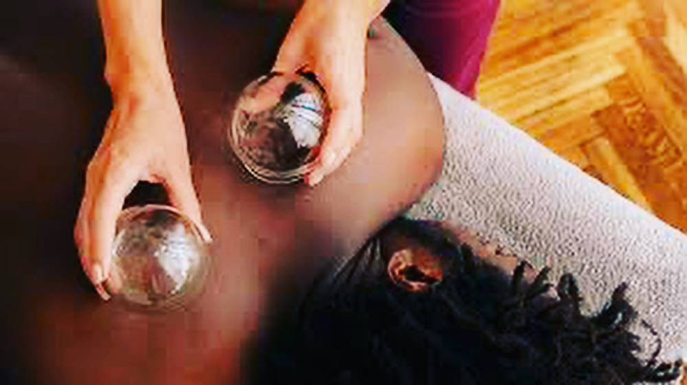 Cupping