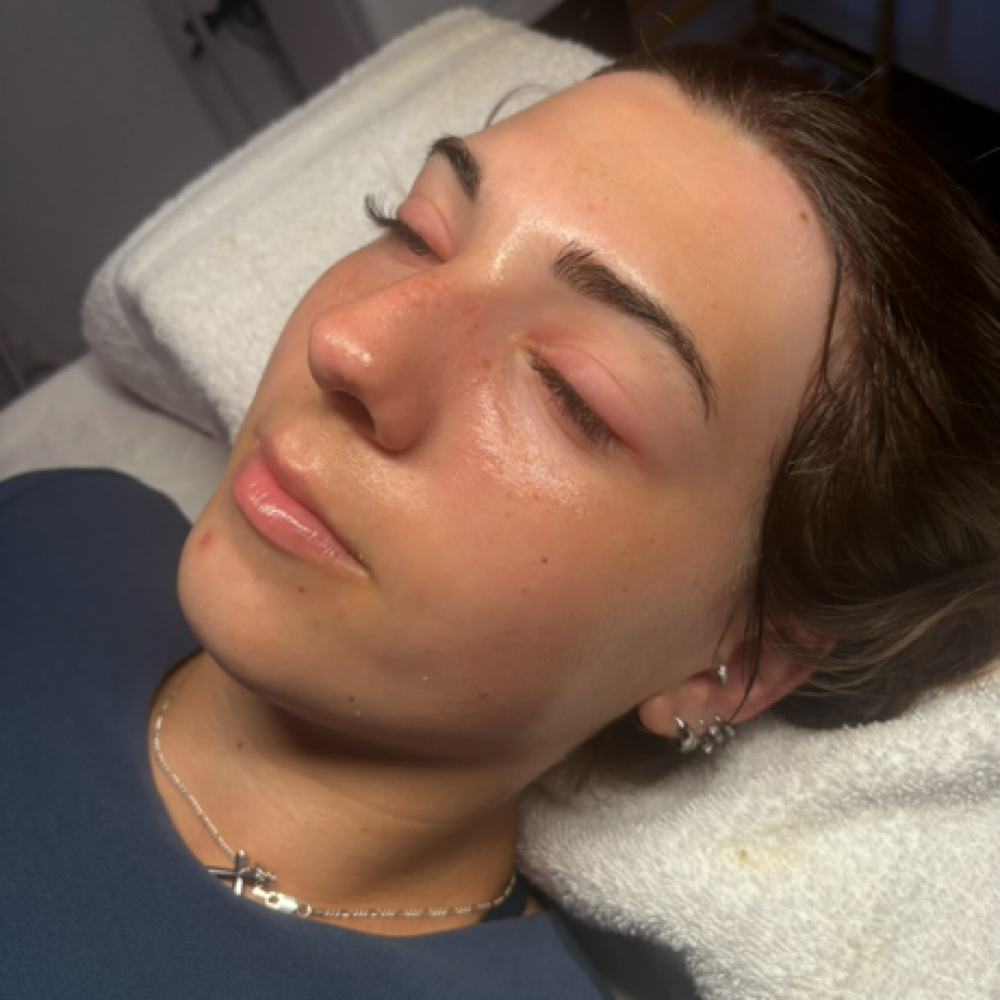Custom Facial 60 Mins at GlowByDawsEsthetics in Abilene, TX
