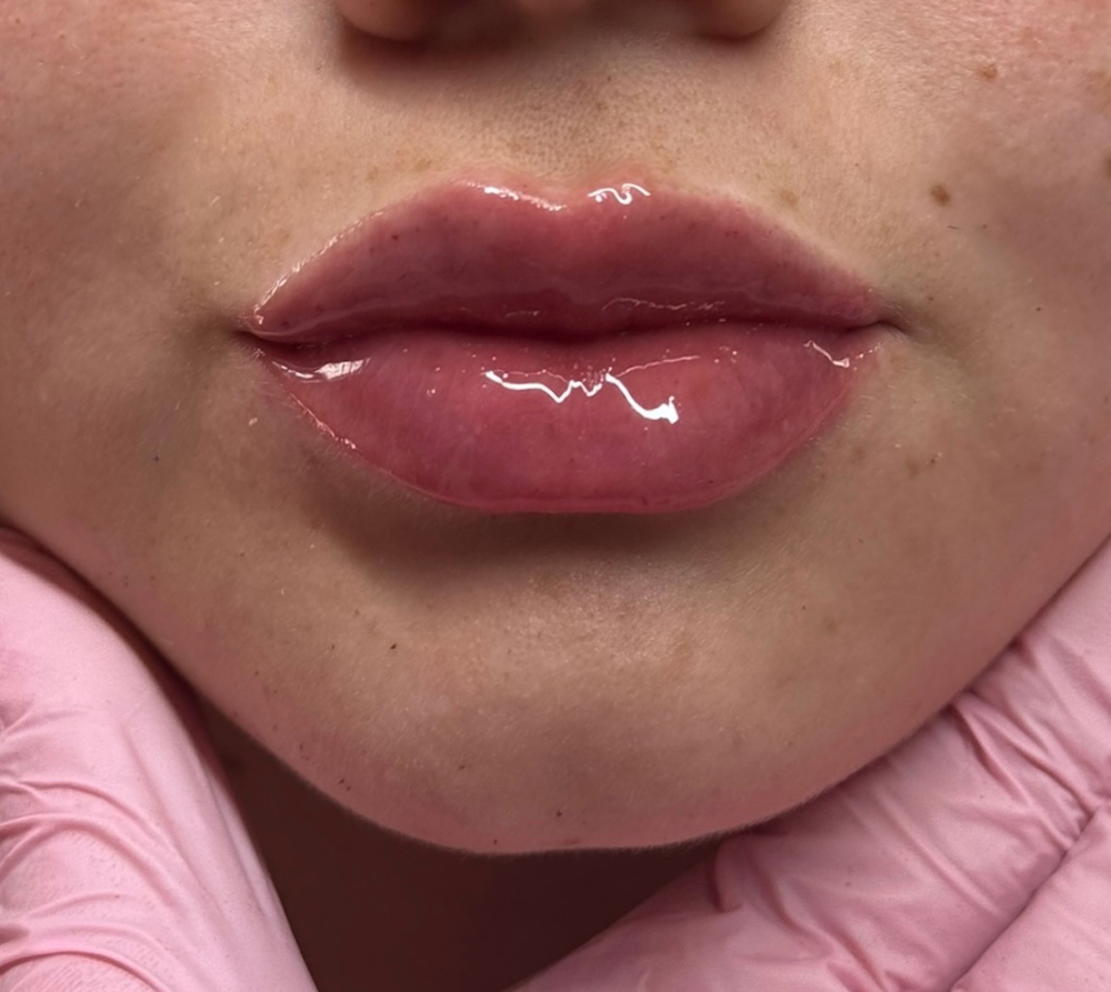 1 ML