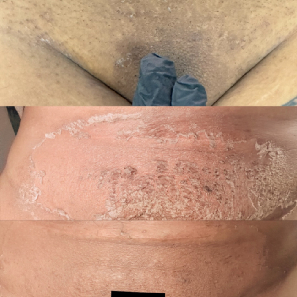 Bikini Lightening ( One Session ) at Studio Belvia in Scottsdale, AZ