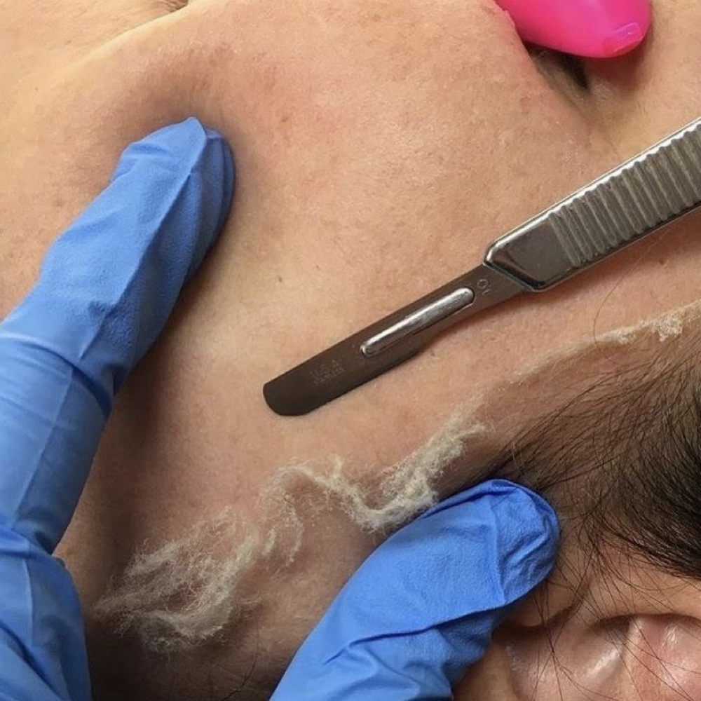 Express Dermaplaning at Esthetics By Alexandra Jensen in Yakima, WA