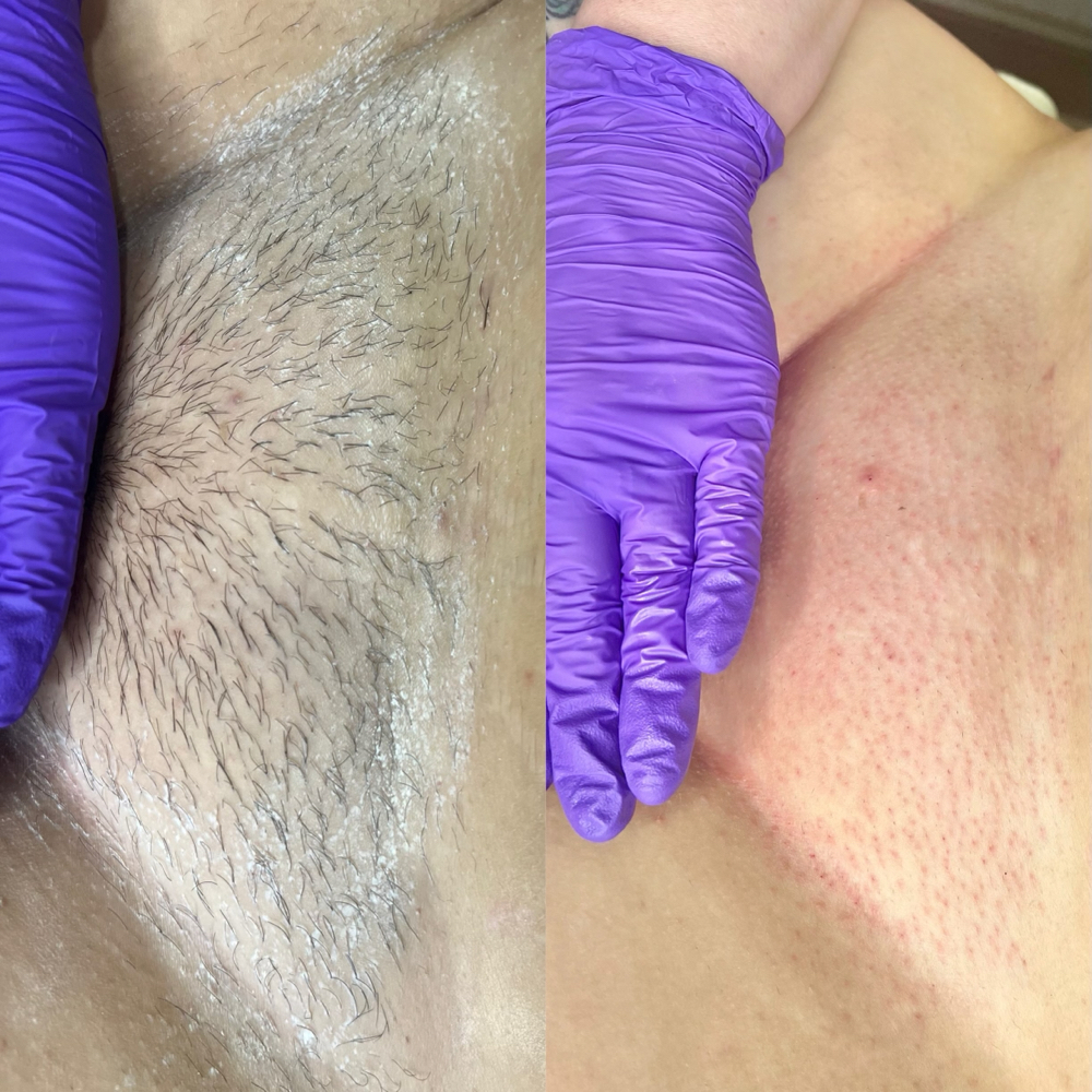 Brazilian Wax