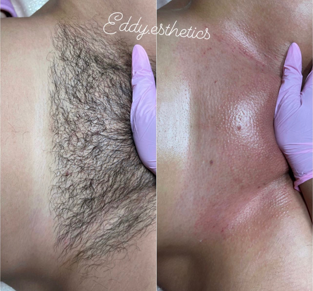 Brazilian Wax