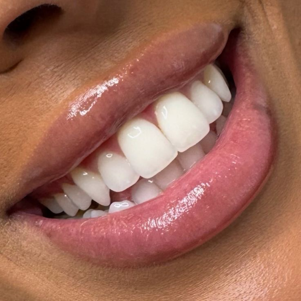 Smile & Plump at Atlas Beauty Haven in Brownsville, TX
