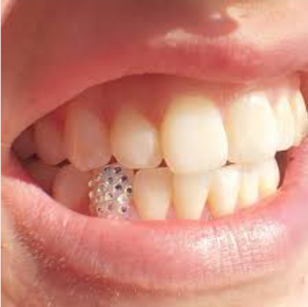 All Glitter- Swarovski-Full Tooth