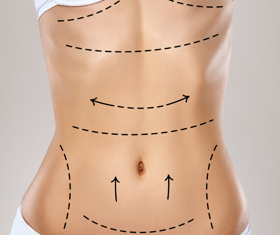 Tummy Tightening | Fibroblast