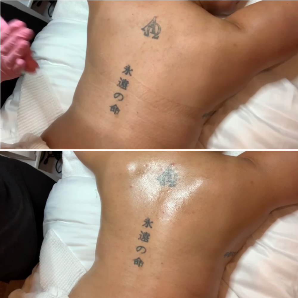 Back Facial
