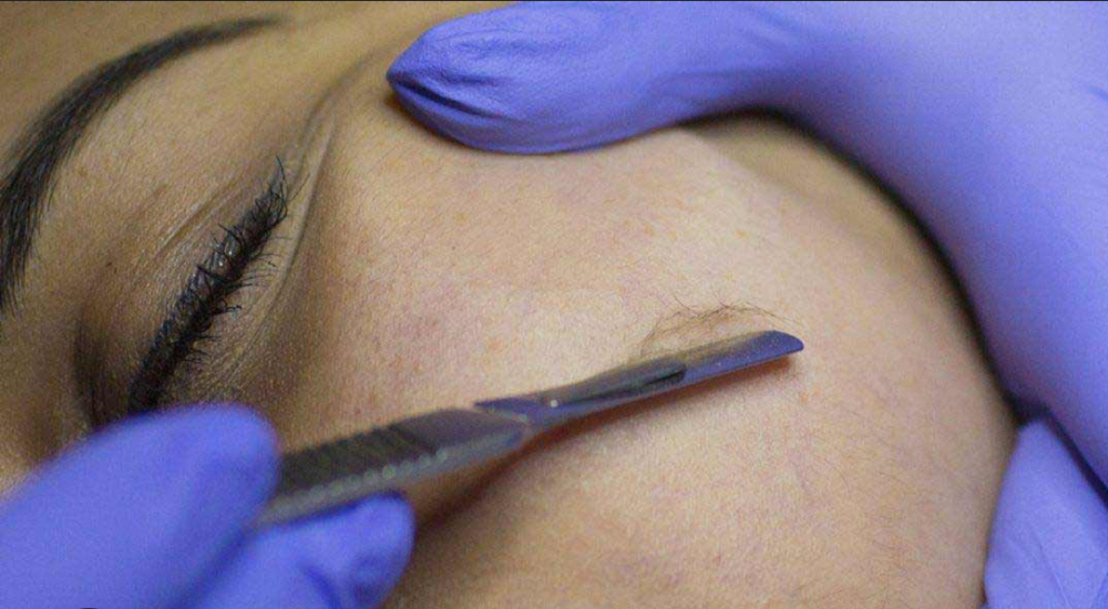Dermaplane Facial