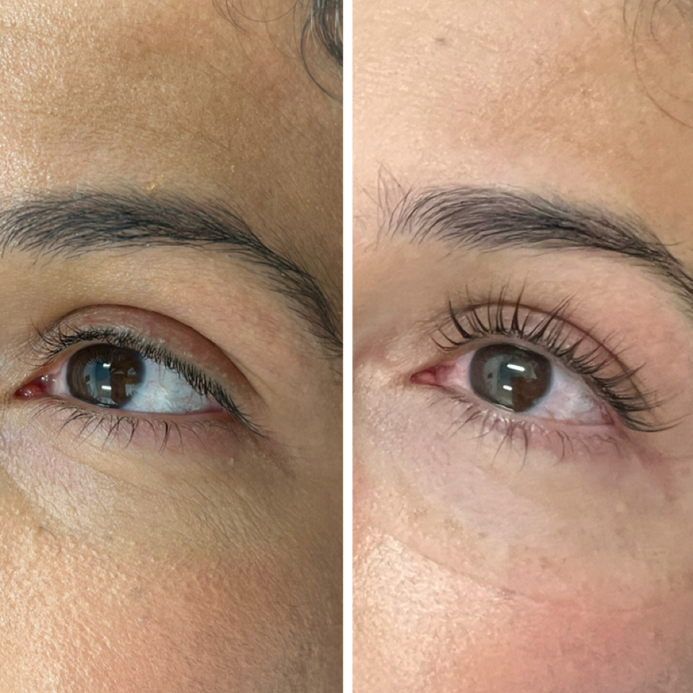 Lash Lift at NCS Aesthetics in Fresno, CA