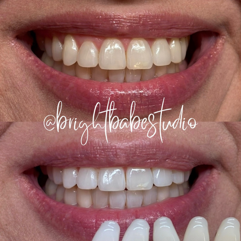 Glow Maintenance Session- 30 Min at Bright Babe Studio in Alice, TX