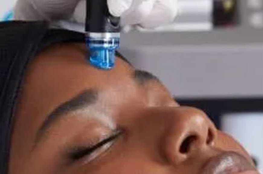 Hydrafacial Designed for You!