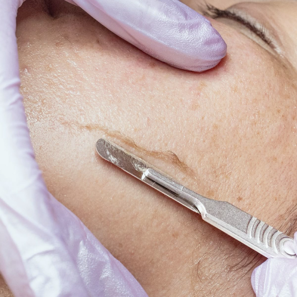 Dermaplaning at Delicate Beauty LLC. in Delta, CO