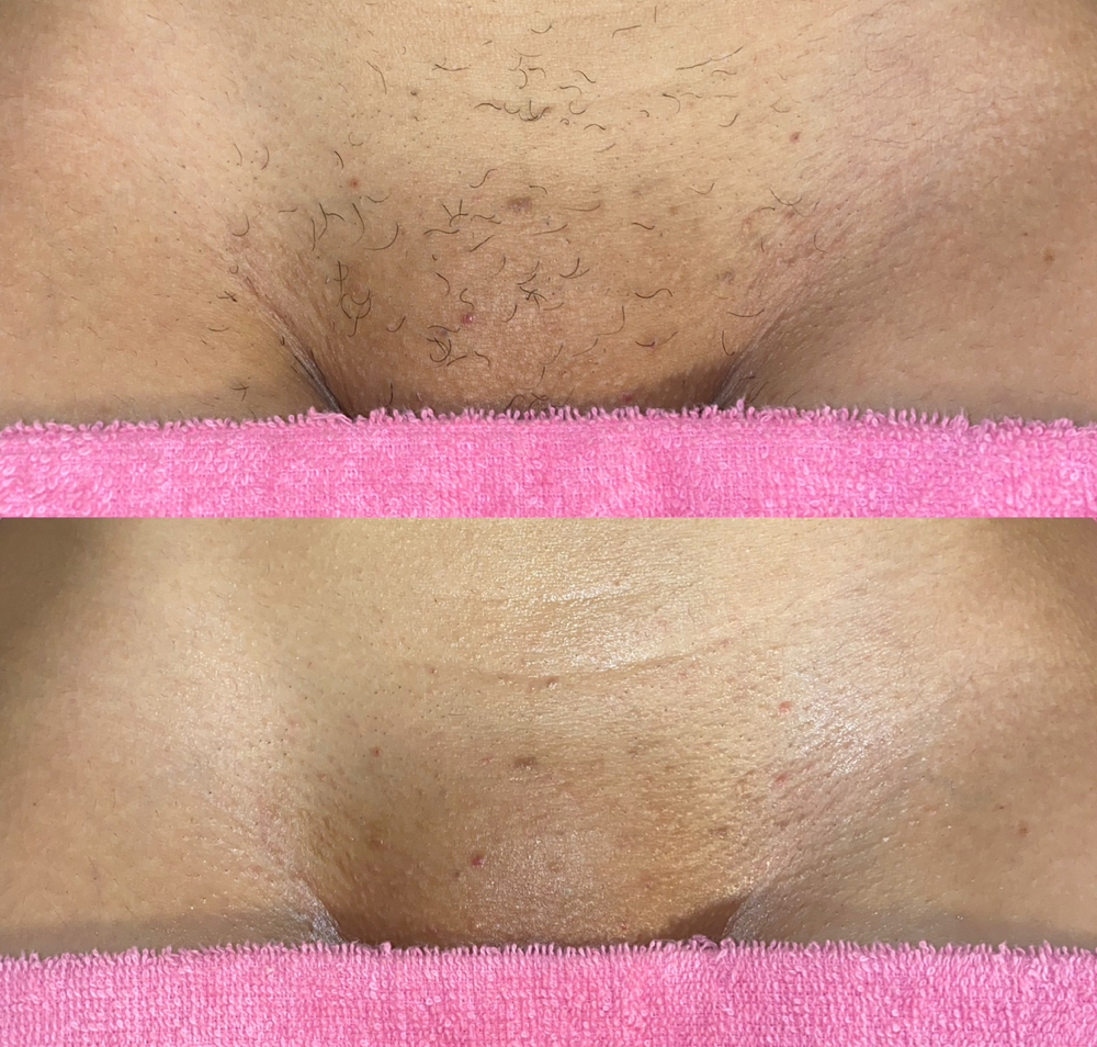 Maintenance Wax (4 Weeks)