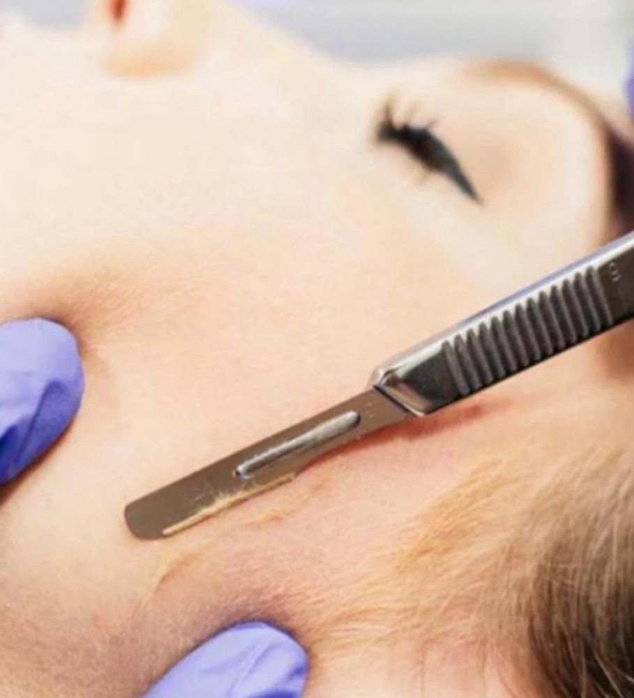 Dermaplaining Facial