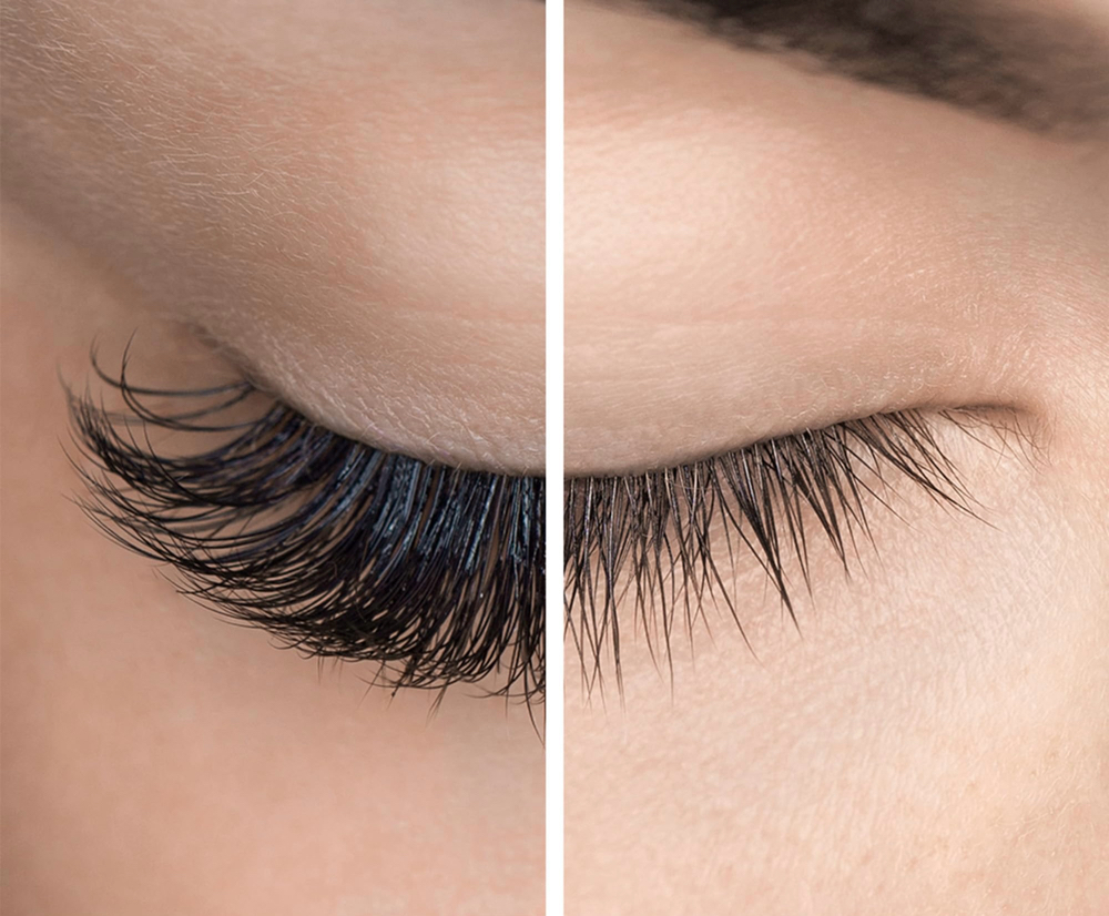 LASH REMOVE