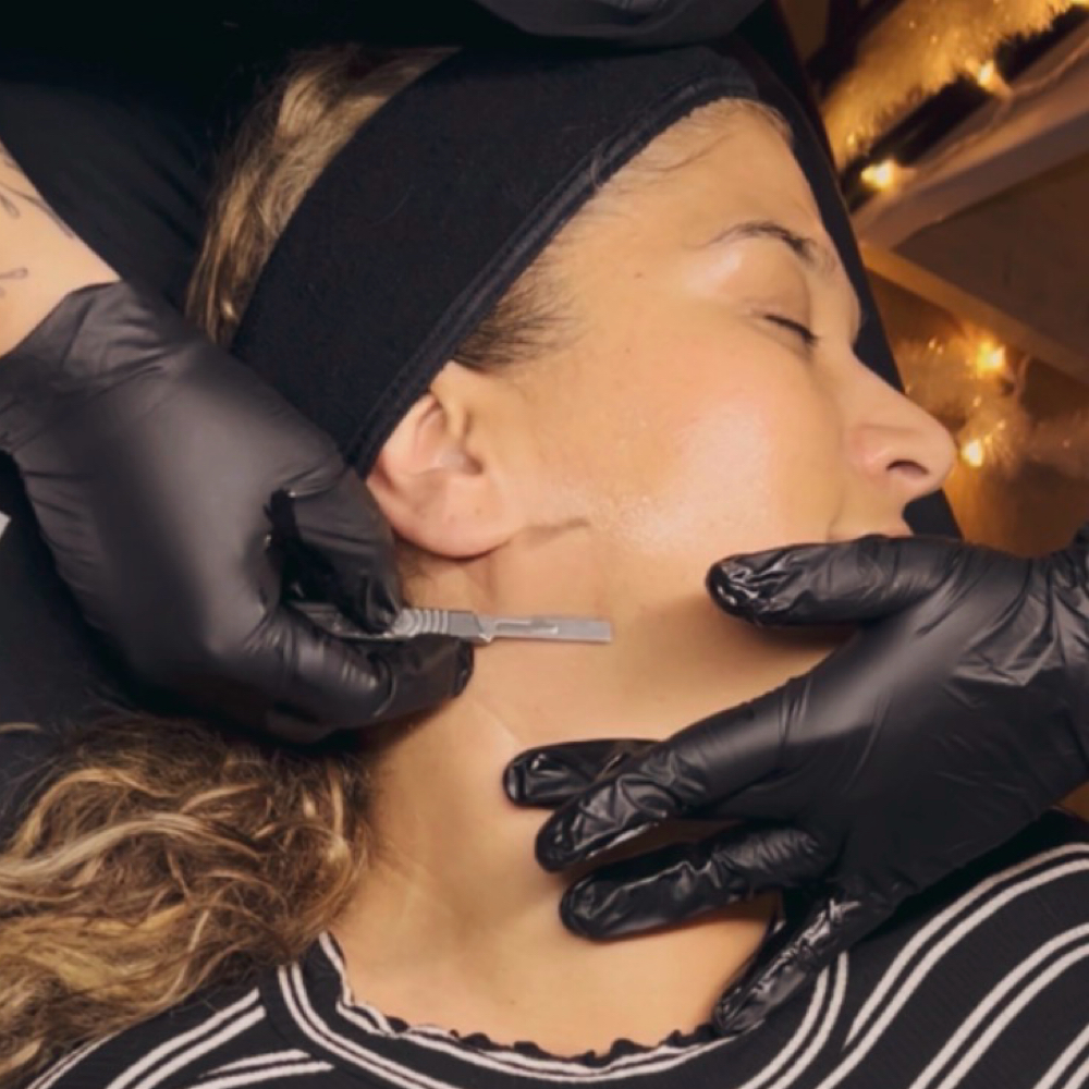 Express Dermaplane at That Rose Glow in Merced, CA