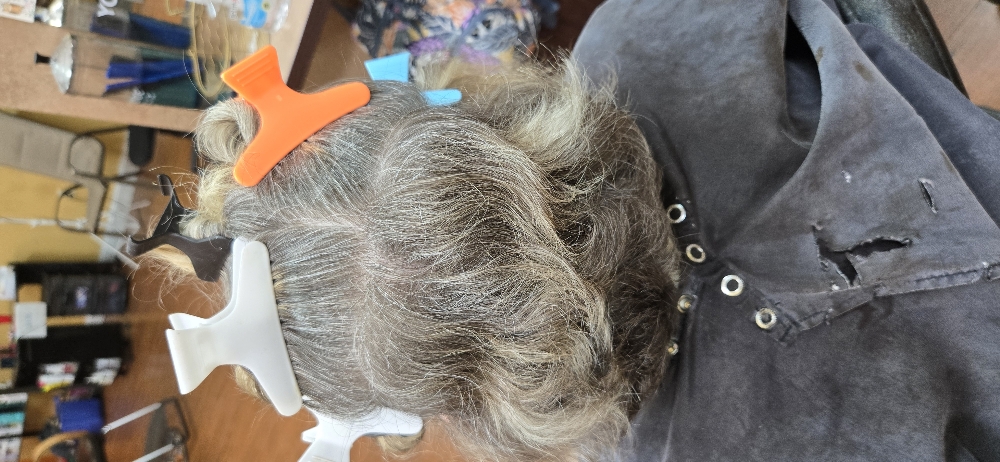 Scalp exfoliation treatment