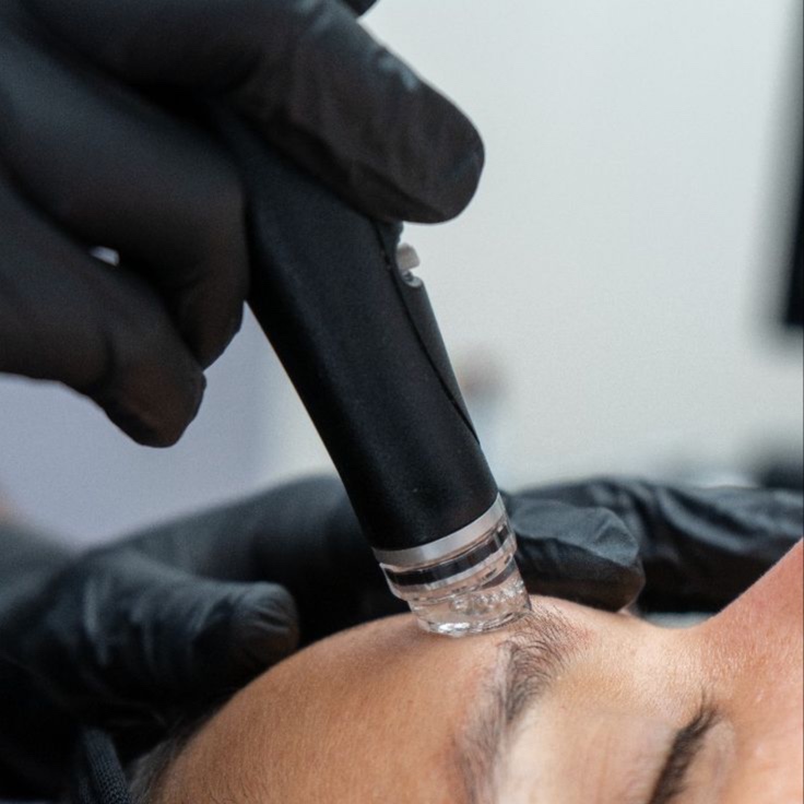 HYDRO FACIAL at Birth of Venus in Los Gatos, CA