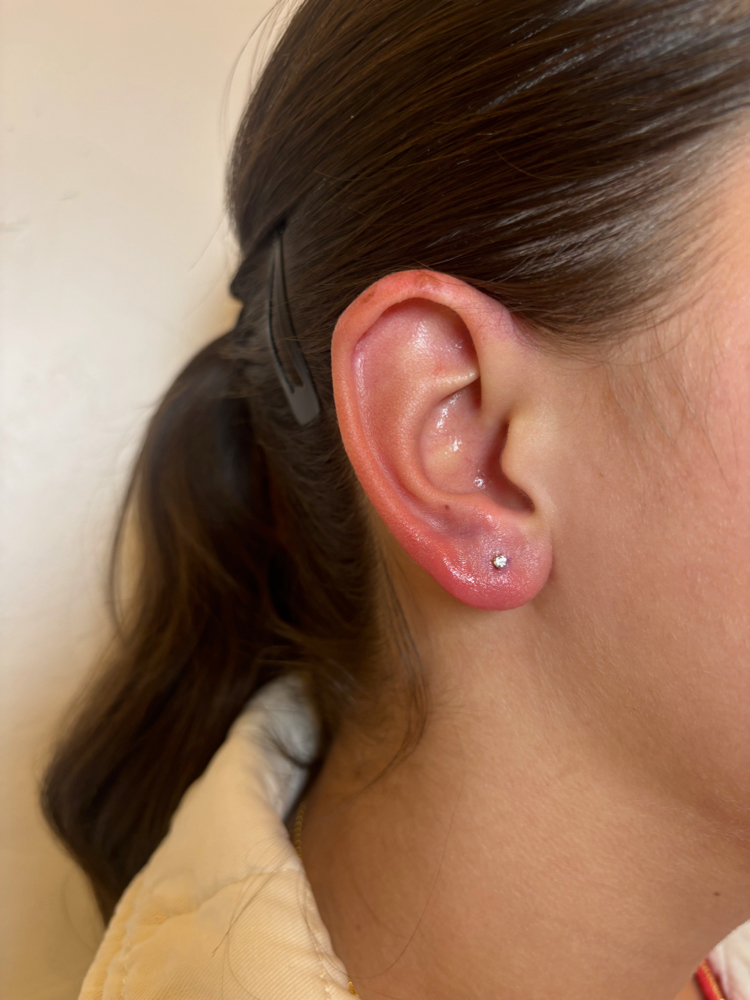 Lobes