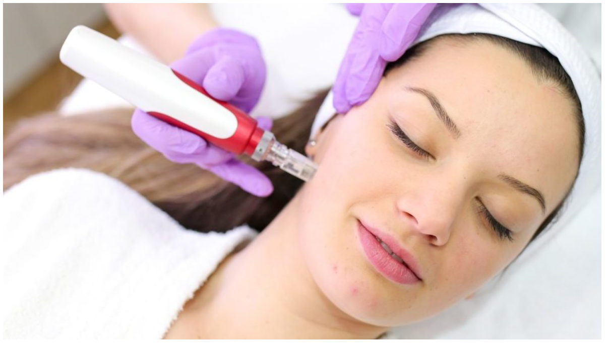 Microneedling Treatment + LED
