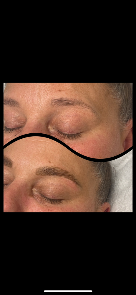 Brow Lamination