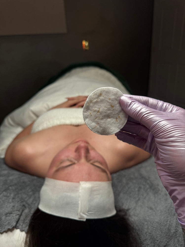 Glow & Go Dermaplane Facial