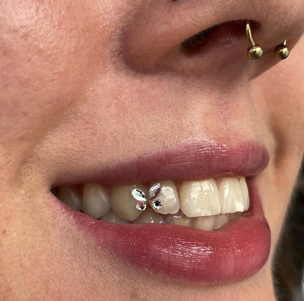 Butterfly Tooth Gem