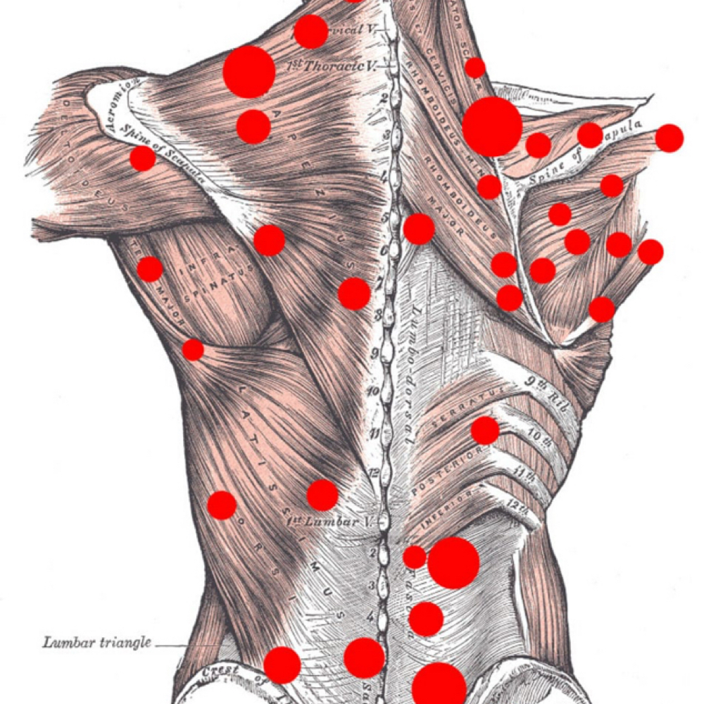 Trigger Point Therapy at Sasha Cain LMT in Toledo, OH