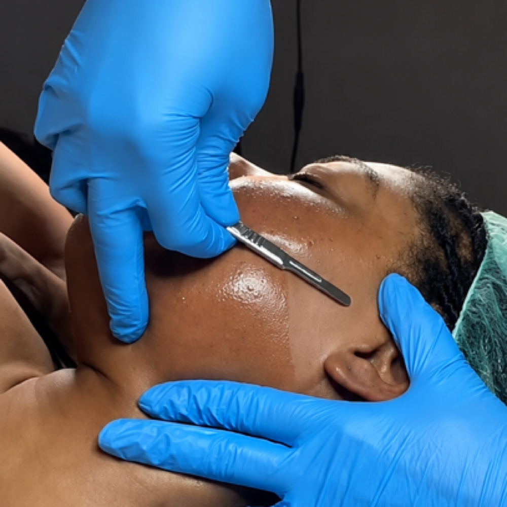 REVEAL | DERMAPLANING FACIAL at Advanced Esthetics Dallas Acne Clinic in Richardson, TX