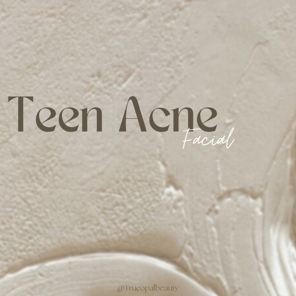 Teen Acne Facial