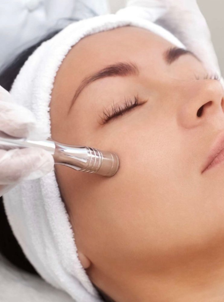 MicroDermabrasion