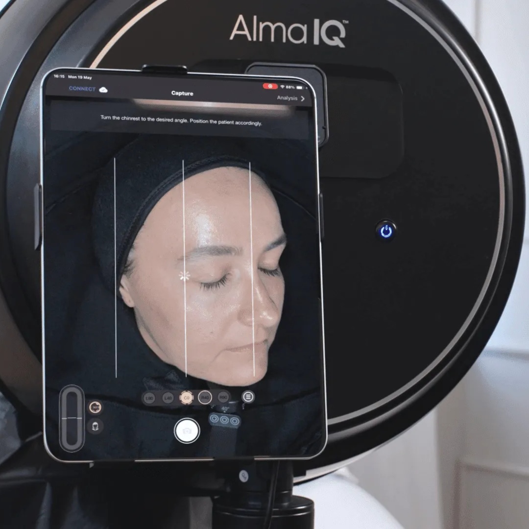 Alma IQ Consultation at Dreamland Health and Wellness in Indianapolis, IN