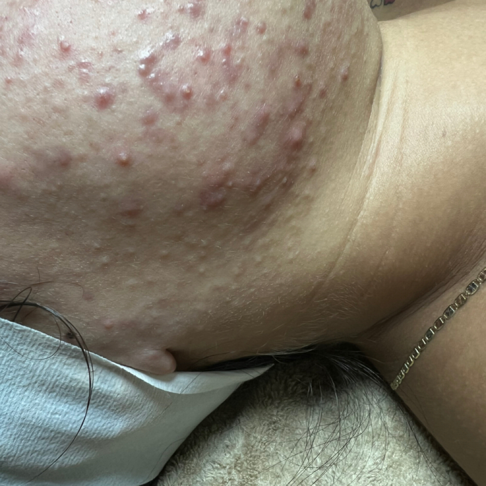 Specialty Facial at He Nani Esthetics in Winchester, CA