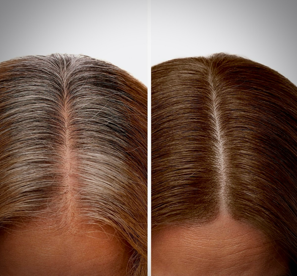 Root Retouch