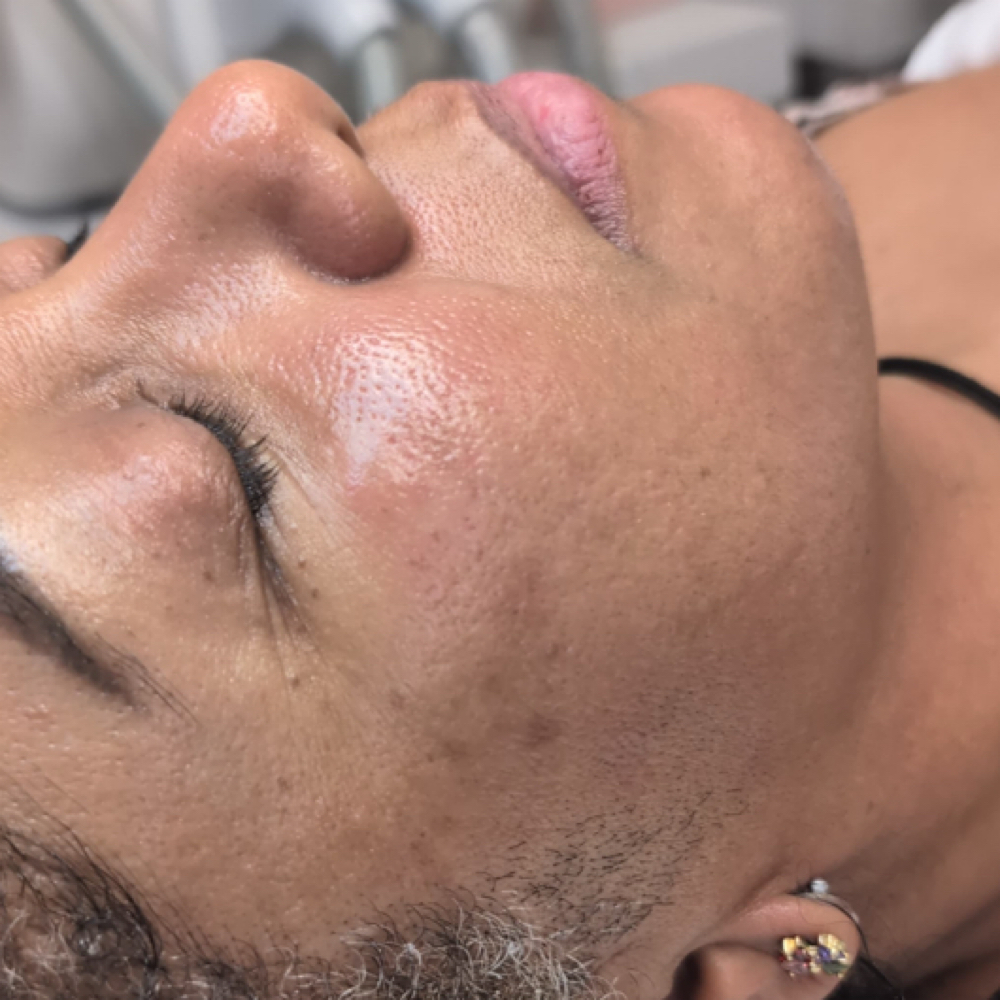 Vitamin C Glow Facial at Nenusk Aesthetics in Long Island City, NY