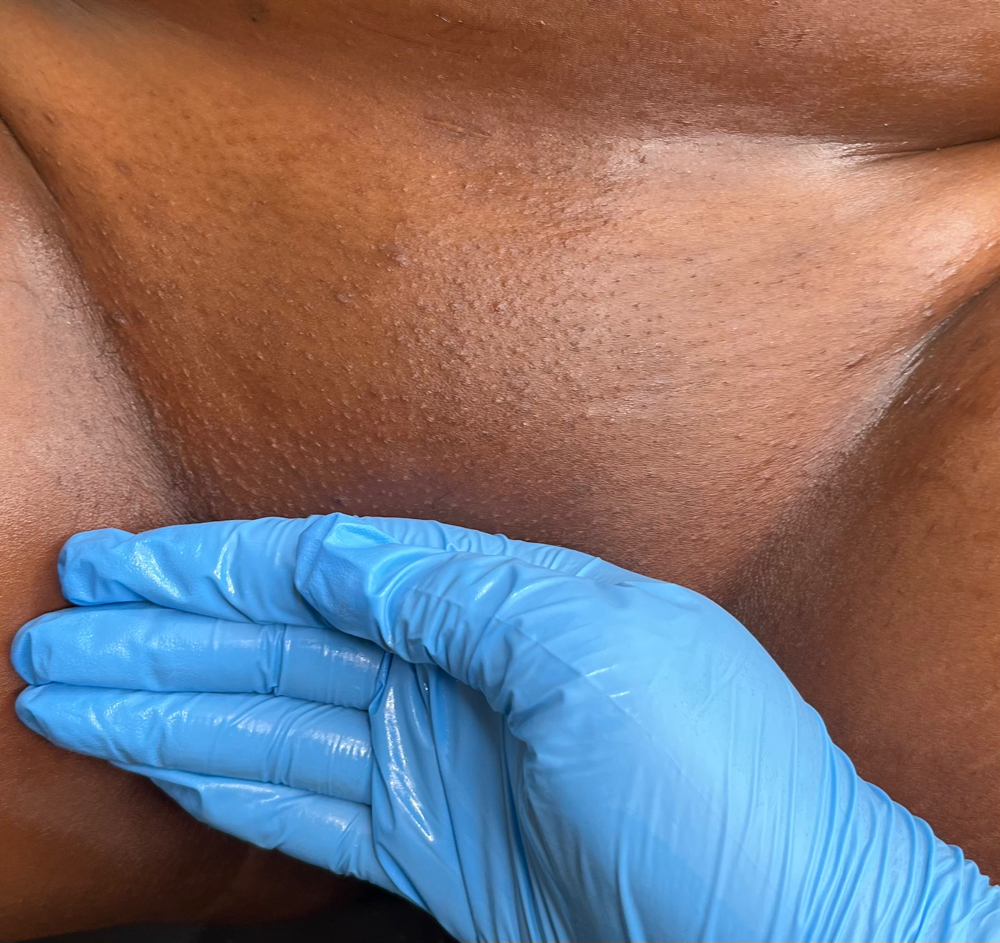 Brazilian Wax