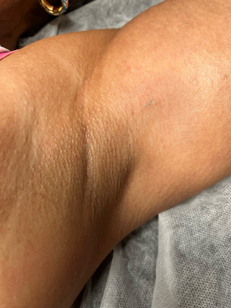 Underarm Wax at Waxing Moon Mobile Esthetics in Saint Cloud, FL