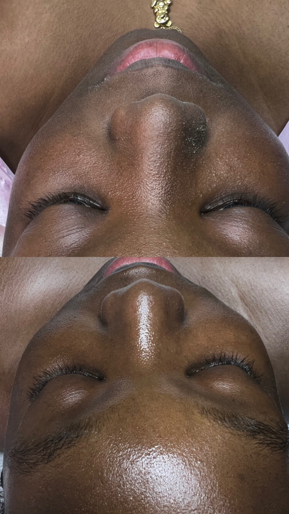 Ashesthetics Facial Experience