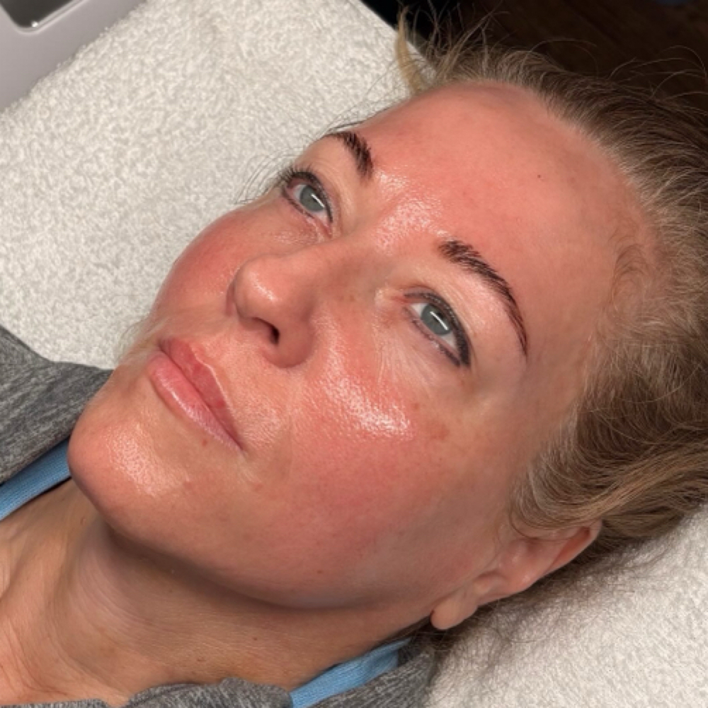 Dermaplane Facial at PR Beauty Bar in Conway, AR
