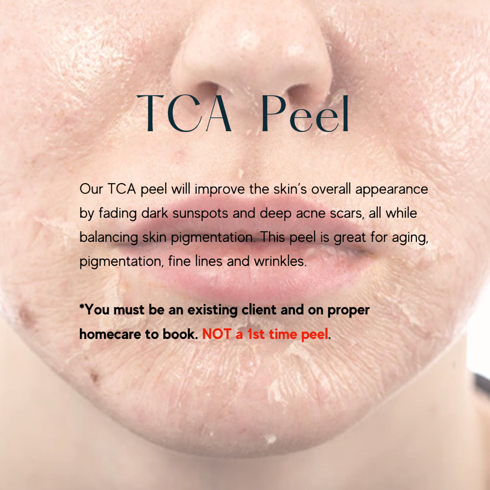 TCA Peel