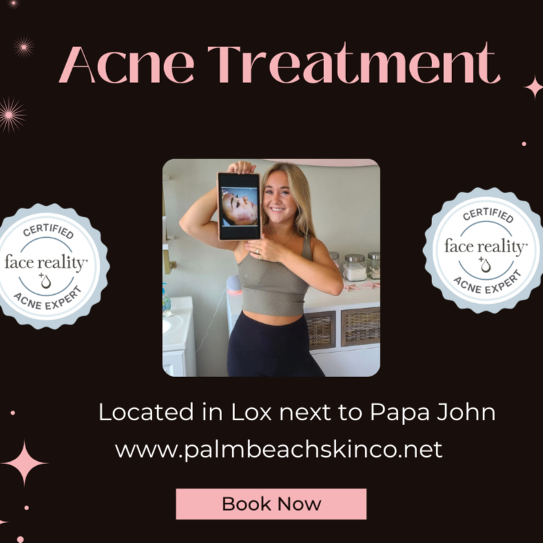 Acne Consultation and Treatment at Palm Beach Skin Co. in Loxahatchee, FL
