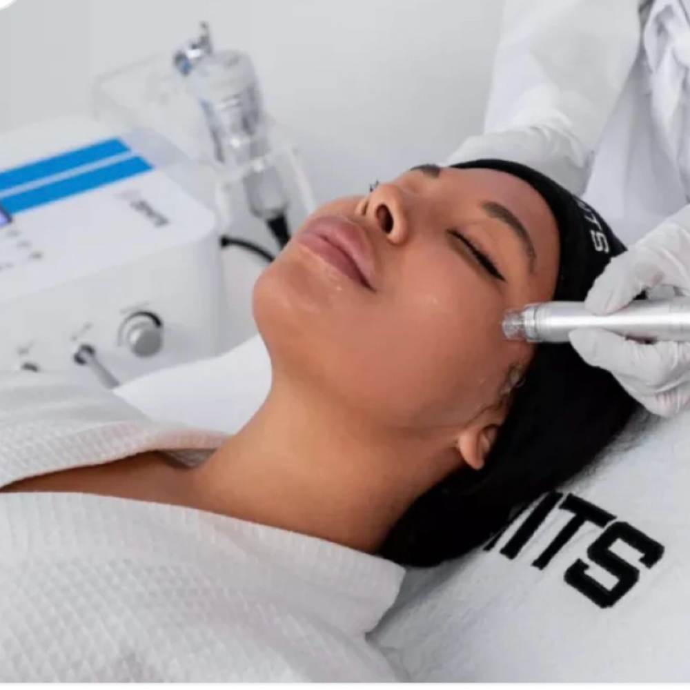 Zemitz Microdermabrasion ( Add On) at Glo by Mel in Ventura, CA