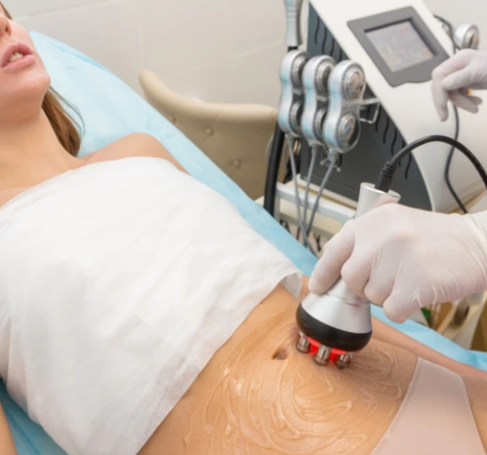 Body RF /Cavitation