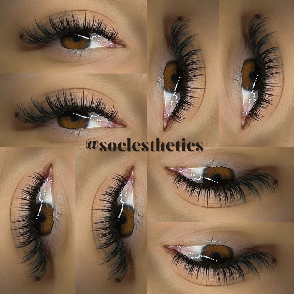 Princess Fill at SOCL Esthetics in Indianapolis, IN