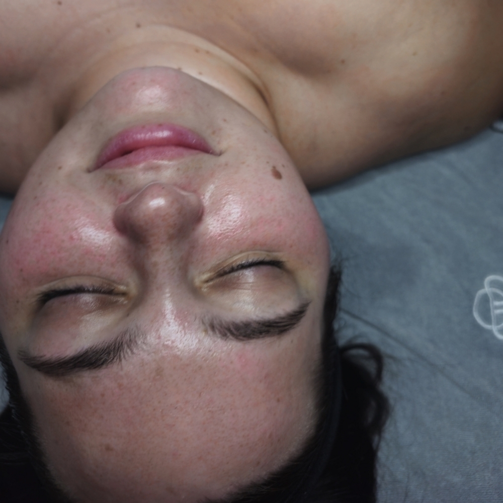 Dermaplane Express Facial at Eternal Esthetics Studio LLC in Dalton, PA