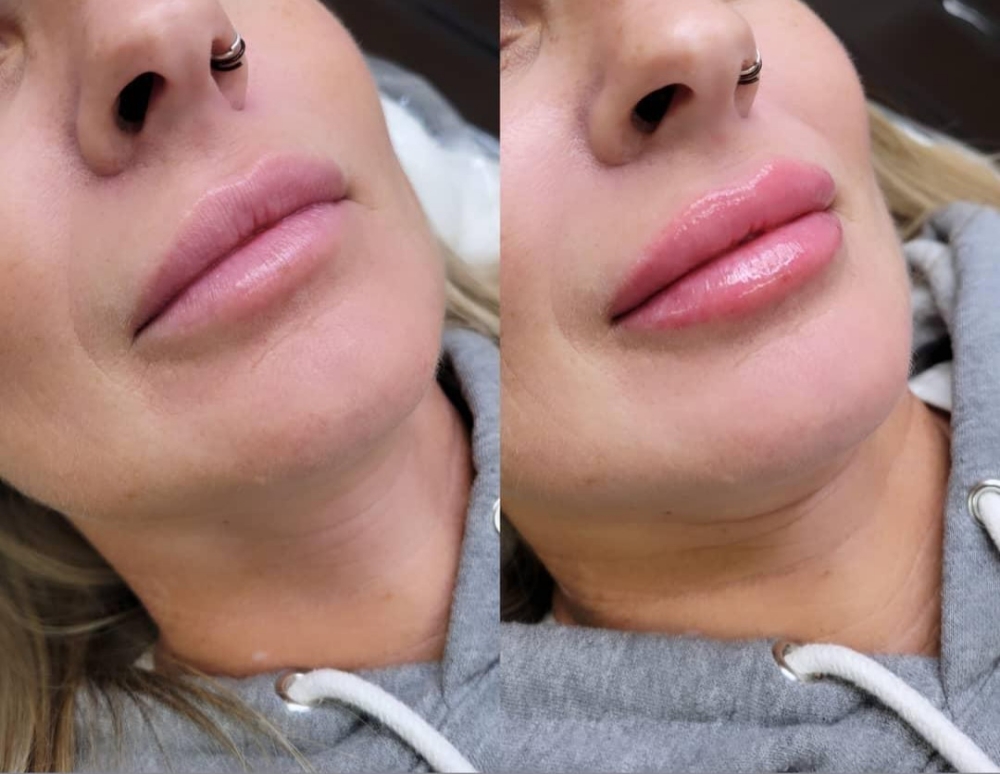 Lip Blush Touch Up 6-8 Weeks