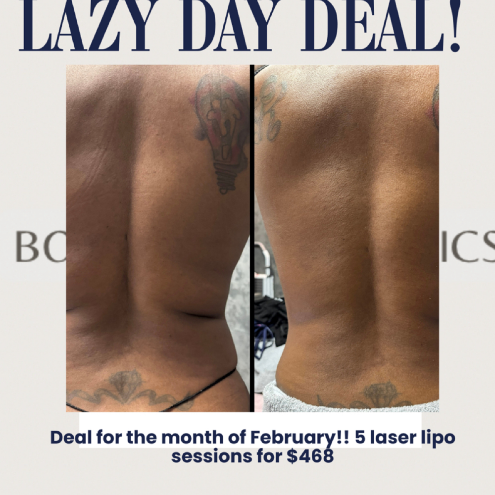 February Deal!!! at Body and Aesthetics in Houston, TX