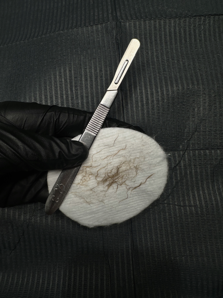 Dermaplane Add On at esthetically yours, corley in Brookhaven, MS